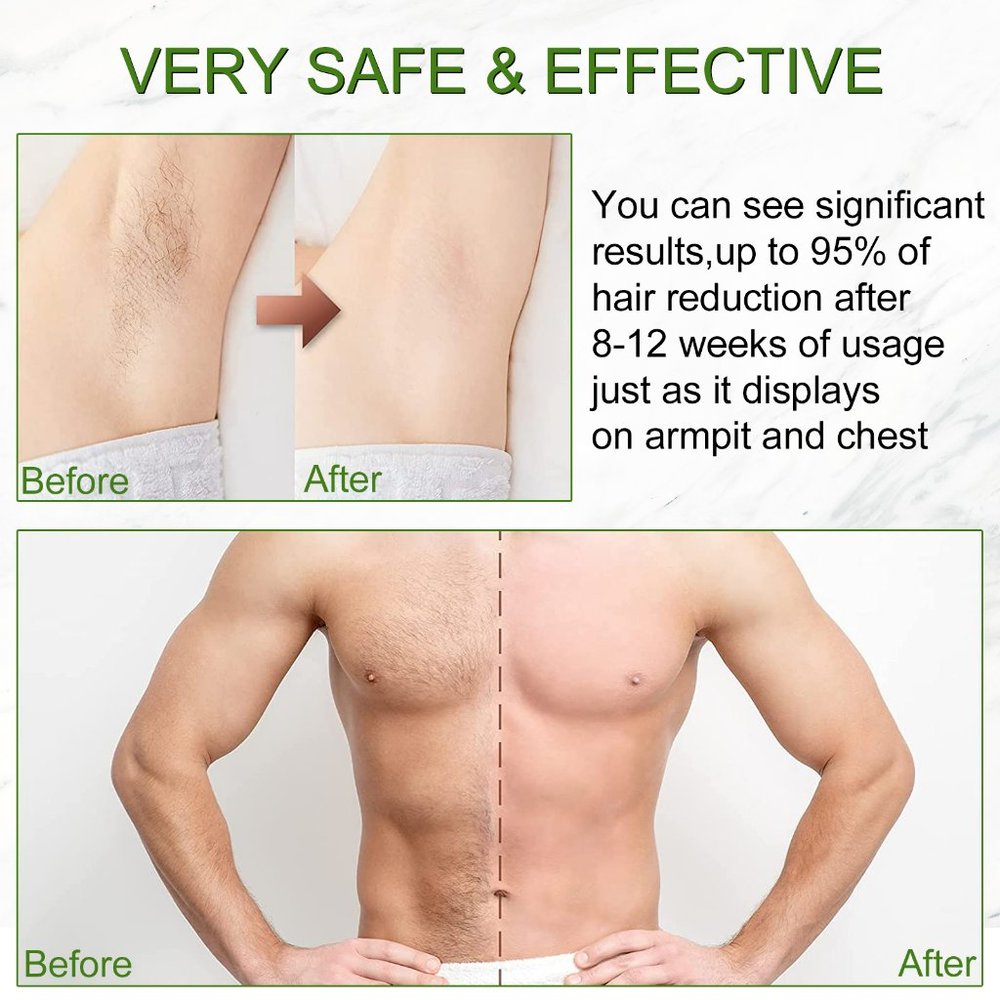 IPL Laser Hair Removal, 500000 Flashes Painless Permanent Hair Removal for Women